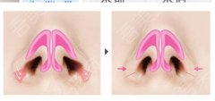 西安美莱医学美容医院怎么样？医院真实点评来了！收费标准介绍