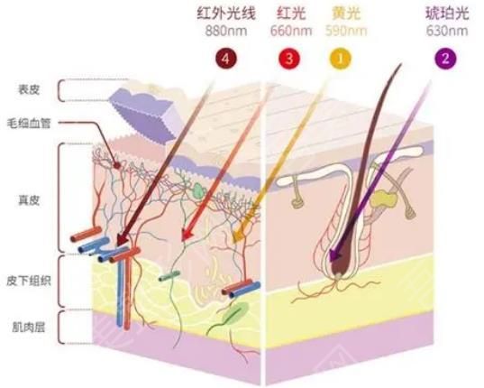 光子嫩肤4.jpg