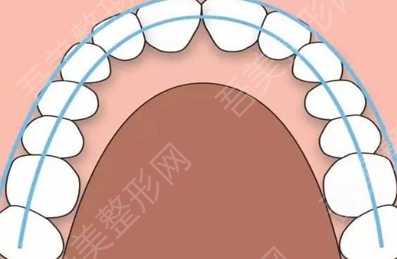 牙齿矫正004.jpg