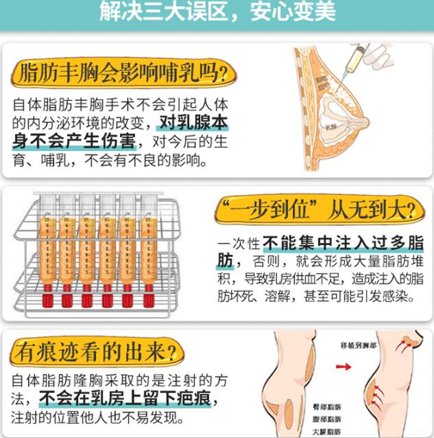 自己脂肪的隆胸手术知识科普