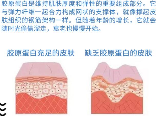 北京协和医院整形科讲解胶原蛋白隆鼻