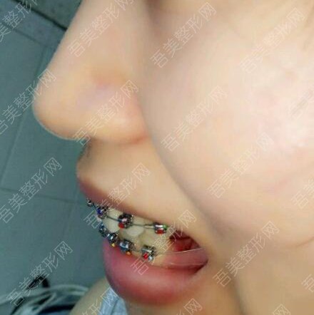 上海牙齿整形公立医院排行