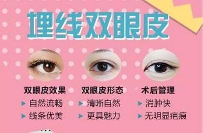 青岛市立医院美容科讲解双眼皮手术