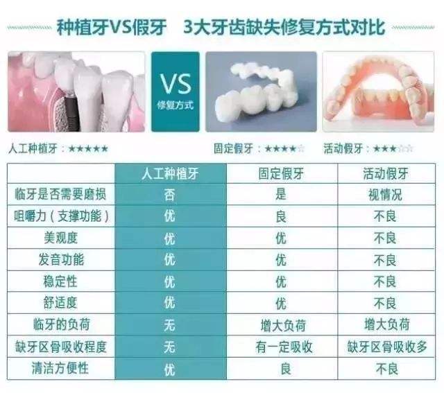 上海永华口腔门诊部科普种植牙手术