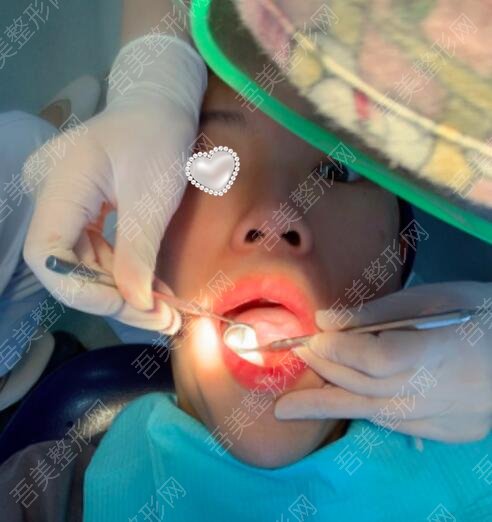 重庆维乐口腔医院牙齿种植案例