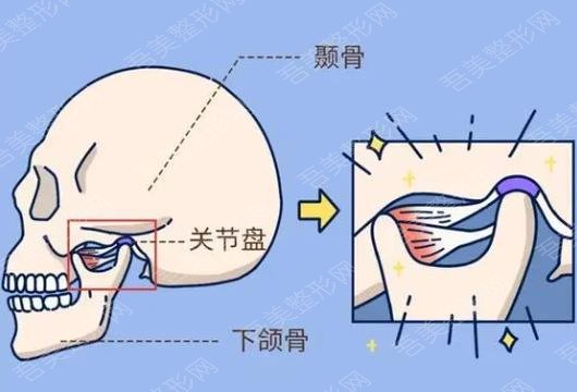 下颌角不对称04.jpg