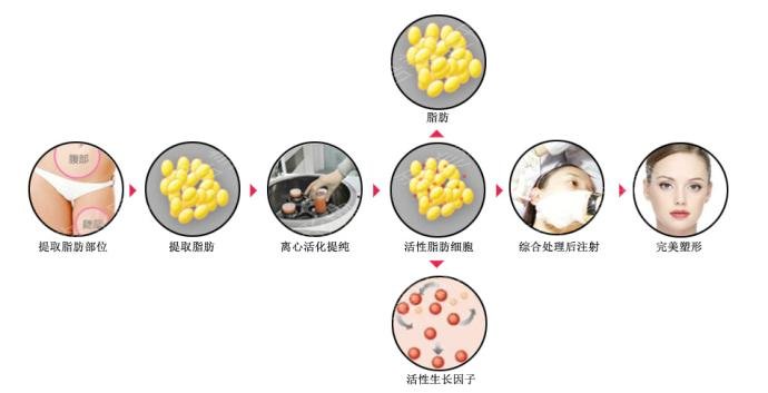 北京国济中医院科普面部填充