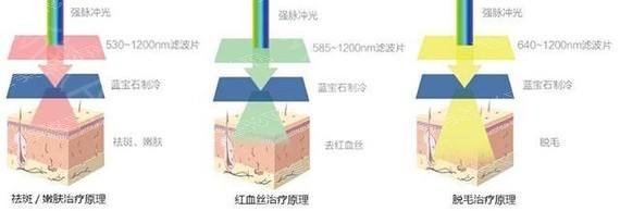 北京臻瑞尚美宋瑜医生科普激光美容