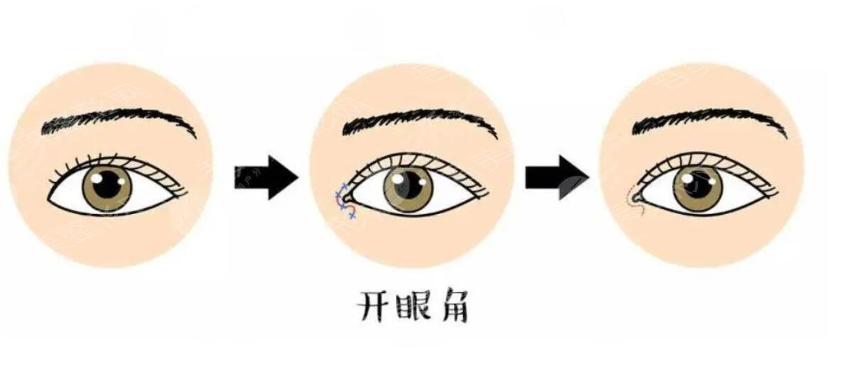 开眼角动漫.jpg